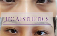 JPC Aesthetics in Chertsey