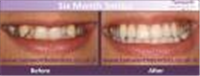 Ascent Dental Care Tamworth in Tamworth