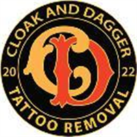 Cloak and Dagger Tattoo Removal in London