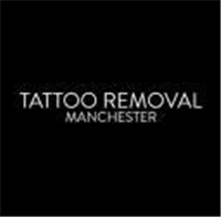 Tattoo Removal Manchester in Manchester