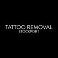 TATTOO REMOVAL STOCKPORT in Stockport